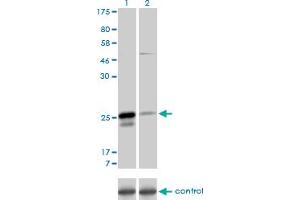 Western blot analysis of MS4A7 over-expressed 293 cell line, cotransfected with MS4A7 Validated Chimera RNAi (Lane 2) or non-transfected control (Lane 1). (MS4A7 抗体  (AA 1-240))