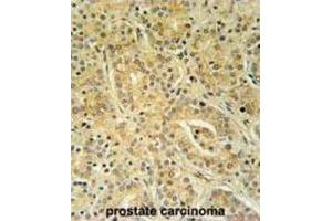 Immunohistochemistry (IHC) image for anti-UBA Domain Containing 1 (UBAC1) antibody (ABIN3002317) (UBAC1 抗体)