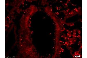 Formalin-fixed and paraffin-embedded rat lung labeled with Anti-Myelin Protein Zero Polyclonal Antibody, Unconjugated  at 1:200 followed by conjugation to the secondary antibody. (MPZ 抗体  (AA 175-248))