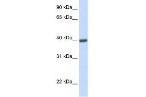 WB Suggested Anti-MAGEA1 Antibody Titration:  0. (MAGEA1 抗体  (N-Term))
