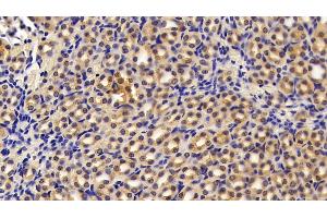 Immunohistochemistry (IHC) image for anti-Pyruvate Kinase M2 (PKM2) (AA 294-470) antibody (ABIN7438913)