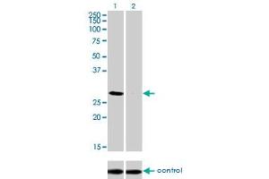 Western blot analysis of DLX4 over-expressed 293 cell line, cotransfected with DLX4 Validated Chimera RNAi (Lane 2) or non-transfected control (Lane 1). (DLX4 抗体  (AA 1-98))