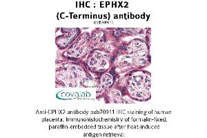 Image no. 2 for anti-Epoxide Hydrolase 2, Cytoplasmic (EPHX2) (C-Term) antibody (ABIN1734088) (EPHX2 抗体  (C-Term))