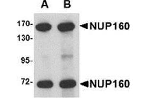 Western blot analysis of NUP160 in rat brain tissue lysate with NUP160 antibody at (A) 0. (NUP160 抗体  (C-Term))