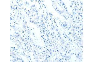 Immunohistochemistry (IHC) image for anti-Cadherin 23 (CDH23) antibody (ABIN1871707) (CDH23 抗体)