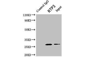 Immunoprecipitating RTP3 in Mouse brain tissue Lane 1: Rabbit control IgG (1 μg) instead of ABIN7167488 in Mouse brain tissue. (RTP3 抗体  (AA 1-211))