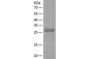 Western Blotting (WB) image for Phosphomannomutase 1 (PMM1) (AA 1-262) protein (His tag) (ABIN7124436) (PMM1 Protein (AA 1-262) (His tag))