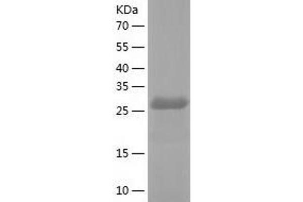 PMM1 Protein (AA 1-262) (His tag)