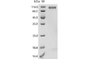 Fms-Related tyrosine Kinase 3 (FLT3) (AA 27-543) protein (His-G4S-Avi Tag)