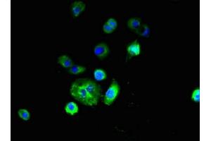 Immunofluorescent analysis of A431 cells using ABIN7151164 at dilution of 1:100 and Alexa Fluor 488-congugated AffiniPure Goat Anti-Rabbit IgG(H+L) (RNF182 抗体  (AA 1-160))