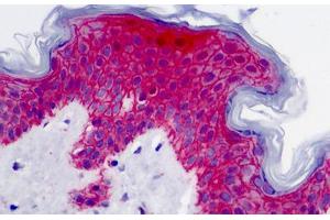 Human Skin: Formalin-Fixed, Paraffin-Embedded (FFPE) (Syndecan 1 抗体)
