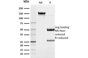 SDS-PAGE Analysis Purified CD117 Mouse Monoclonal Antibody (KIT/982). (KIT 抗体  (AA 100-300))