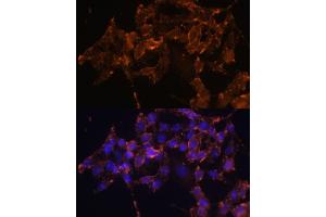 Immunofluorescence analysis of HeLa cells using COX1/COX1/PTGS1 Polyclonal Antibody (ABIN6130124, ABIN6146413, ABIN6146414 and ABIN6223187) at dilution of 1:100 (40x lens). (PTGS1 抗体  (AA 1-180))