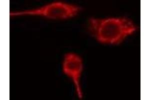 ABIN6275674 staining HuvEc cells by IF/ICC. (VTI1B 抗体  (Internal Region))