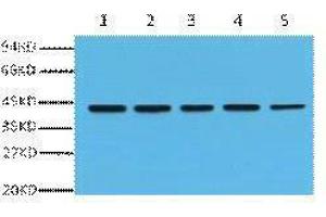 Western Blotting (WB) image for anti-Actin, beta (ACTB) antibody (ABIN3181101) (beta Actin 抗体)