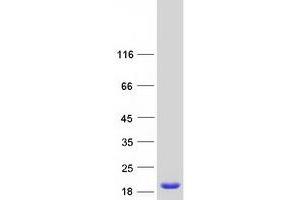Retinol Binding Protein 5, Cellular (RBP5) protein (Myc-DYKDDDDK Tag)