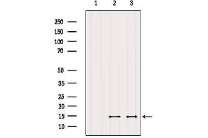 Western blot analysis of extracts from various samples, using SERF2 Antibody. (SERF2 抗体  (N-Term))
