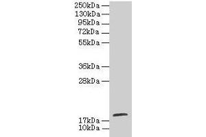 Western blot All lanes: TPPP2 antibody at 8 μg/mL + HepG2 whole cell lysate Secondary Goat polyclonal to rabbit IgG at 1/10000 dilution Predicted band size: 19 kDa Observed band size: 19 kDa (TPPP2 抗体  (AA 1-170))