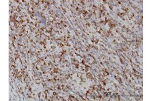 Image no. 2 for anti-RAB27A, Member RAS Oncogene Family (RAB27A) (AA 122-222) antibody (ABIN598569) (RAB27A 抗体  (AA 122-222))