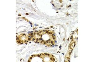 Immunohistochemistry (Paraffin-embedded Sections) (IHC (p)) image for anti-Activating Transcription Factor 2 (ATF2) (AA 1-190) antibody (ABIN3023064)