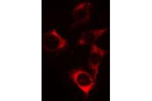 ABIN6269192 staining Hela cells by IF/ICC. (CBL 抗体  (Internal Region))