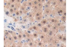 DAB staining on IHC-P; Samples: Rat Liver Tissue (ADAM1 抗体  (AA 463-727))