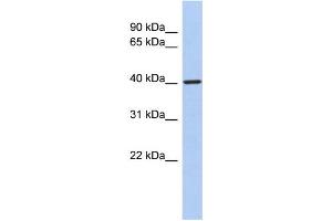 WB Suggested Anti-LDB2 Antibody Titration:  0. (LIM Domain Binding 2 Protein 抗体  (Middle Region))