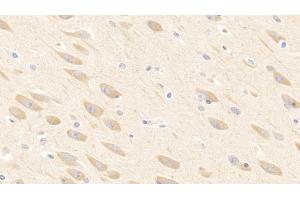 Immunohistochemistry (IHC) image for anti-Adiponectin (ADIPOQ) (AA 17-243) antibody (ABIN7432166)