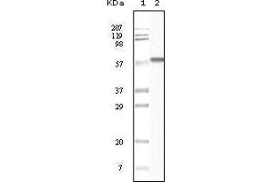 Western blot analysis using CK1 mouse mAb against truncated CK1 recombinant protein. (CSNK1A1 抗体)