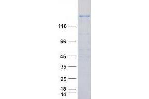 Activity Assay (AcA) image for Receptor Tyrosine-Protein Kinase ErbB-3 (ERBB3) (Transcript Variant 1) protein (Myc-DYKDDDDK Tag) (ABIN2720372)