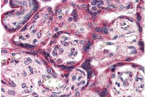 Placenta, Human: Formalin-Fixed, Paraffin-Embedded (FFPE) (EPHX2 抗体  (C-Term))