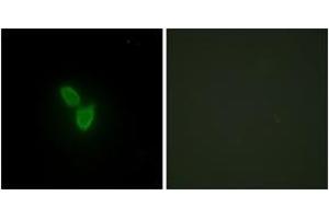 Immunofluorescence analysis of HepG2 cells, using PARD3 Antibody. (PARD3 抗体  (AA 1141-1190))