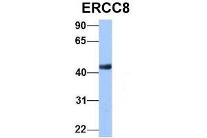 Western Blotting (WB) image for anti-Excision Repair Cross-Complementing Rodent Repair Deficiency, Complementation Group 8 (ERCC8) (C-Term) antibody (ABIN2777347)