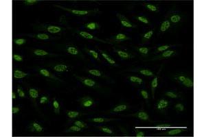 Immunofluorescence of monoclonal antibody to OXSR1 on HeLa cell. (OXSR1 抗体  (AA 351-450))