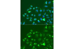 Immunofluorescence analysis of A549 cell using ATF3 antibody. (ATF3 抗体)