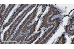 IHC analysis of PARP using anti-PARP antibody (ABIN7602277). (PARP1 抗体  (AA 670-858))