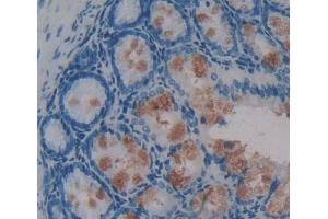 Used in DAB staining on fromalin fixed paraffin- embedded intestine tissue (Phospholipase C beta 2 抗体  (AA 1-250))