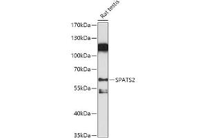 Western blot analysis of extracts of Rat testis, using SP antibody (ABIN7270526) at 1:1000 dilution. (SPATS2 抗体  (AA 1-240))