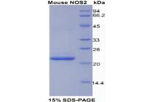 SDS-PAGE analysis of Mouse NOS2 Protein. (NOS2 蛋白)
