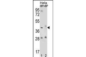 Western blot analysis of HYAL2 Antibody Pab pre-incubated without(lane 1) and with(lane 2) blocking peptide in Hela cell line lysate. (HYAL2 抗体  (AA 128-157))