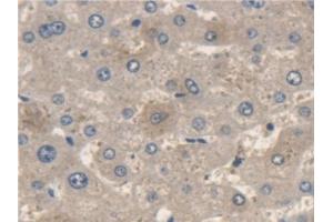 Detection of ME2 in Human Liver Tissue using Polyclonal Antibody to Malic Enzyme 2, NADP+ Dependent, Mitochondrial (ME2) (Malic Enzyme 2, NADP+ Dependent, Mitochondrial (AA 220-426) 抗体)