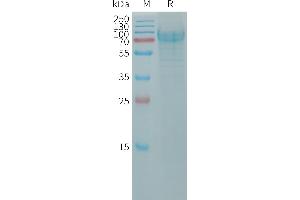SDS-PAGE (SDS) image for Podocalyxin-Like 2 (PODXL2) (AA 33-499) protein (His tag) (ABIN7491303)