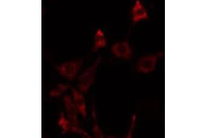 ABIN6275765 staining NIH-3T3 by IF/ICC. (FGFRL1 抗体  (Internal Region))