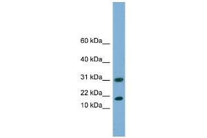 WB Suggested Anti-EIF5A2 Antibody Titration: 0. (EIF5A2 抗体  (N-Term))
