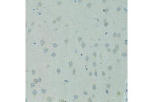 Immunohistochemistry of paraffin-embedded rat brain using SMAD6 antibody. (SMAD6 抗体)