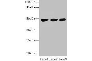 Western blot All lanes: UXS1 antibody at 6 μg/mL Lane 1: Mouse lung tissue Lane 2: Jurkat whole cell lysate Lane 3: HepG2 whole cell lysate Secondary Goat polyclonal to rabbit IgG at 1/10000 dilution Predicted band size: 48, 49, 29 kDa Observed band size: 48 kDa (UXS1 抗体  (AA 201-420))