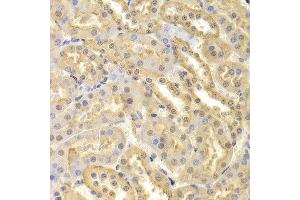 Immunohistochemistry of paraffin-embedded Mouse kidney using CDK9 antibody at dilution of 1:100 (x400 lens).