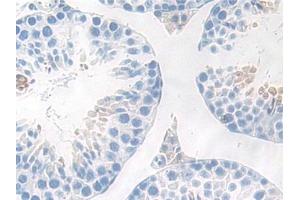 DAB staining on IHC-P; Samples: Mouse Testis Tissue (IKbIP 抗体  (AA 78-301))