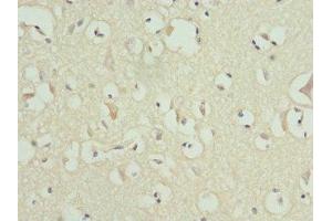 Immunohistochemistry of paraffin-embedded human brain tissue using ABIN7159178 at dilution of 1:100 (MATK 抗体  (AA 393-507))