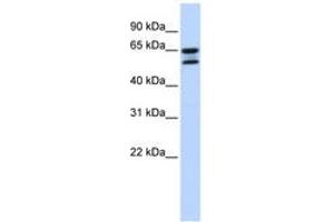 Image no. 1 for anti-Acyl-CoA Thioesterase 11 (ACOT11) (AA 504-553) antibody (ABIN6743818) (ACOT11 抗体  (AA 504-553))